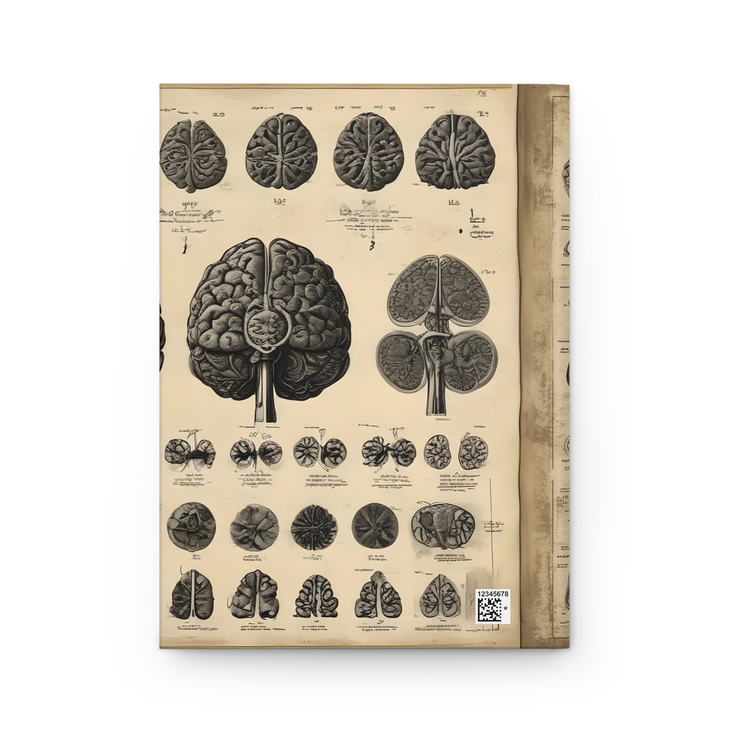 Hardcover Journal Matte - Vintage Anatomical Brains Illustration